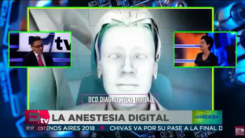 Anestesia Digital en Excelsior TV | La Clínica Dental