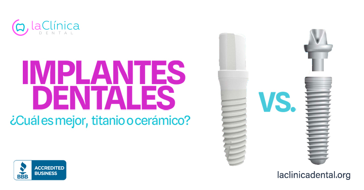 Implantes dentales de titanio y cerámico comparados, La Clínica Dental, información sobre opciones de implantes.