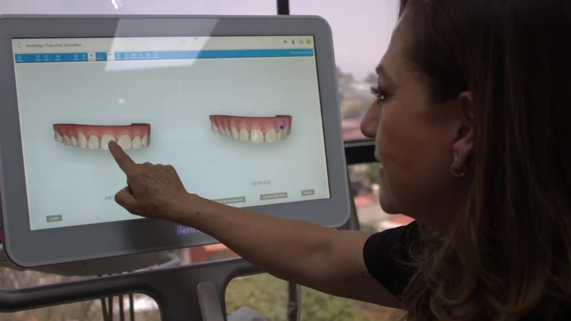 Mujer señalando en pantalla digital simulador de resultados de diseño de sonrisa en La Clínica Dental, CDMX.