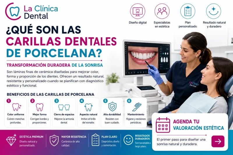 Carillas Dentales de Porcelana
